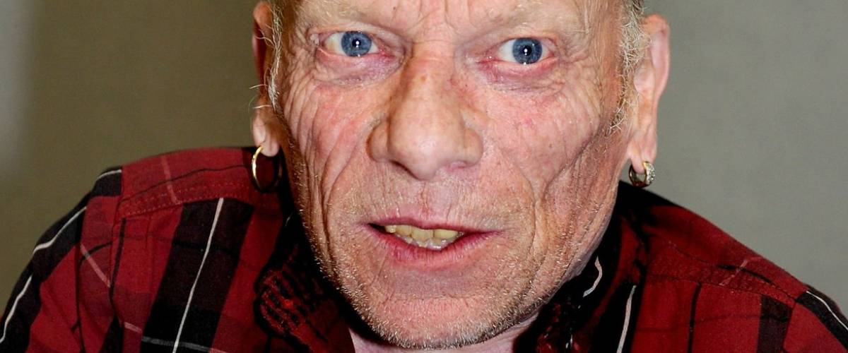 Jimmy Vee